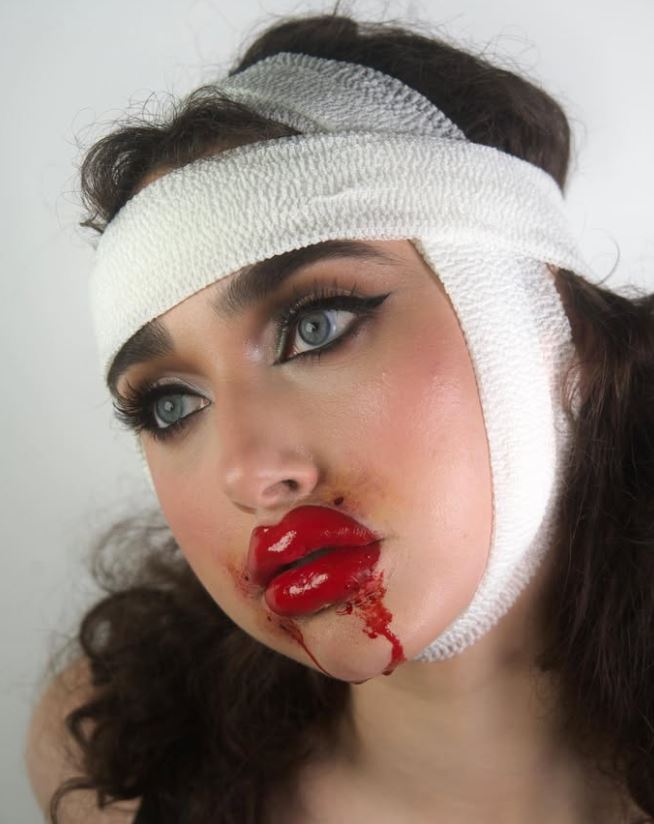 Iniezioni alle labbra - Trasferimento Glam Gore FX