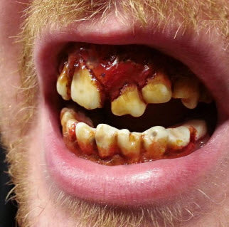 Teeth FX